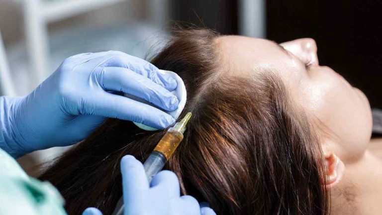 Hair Transplant